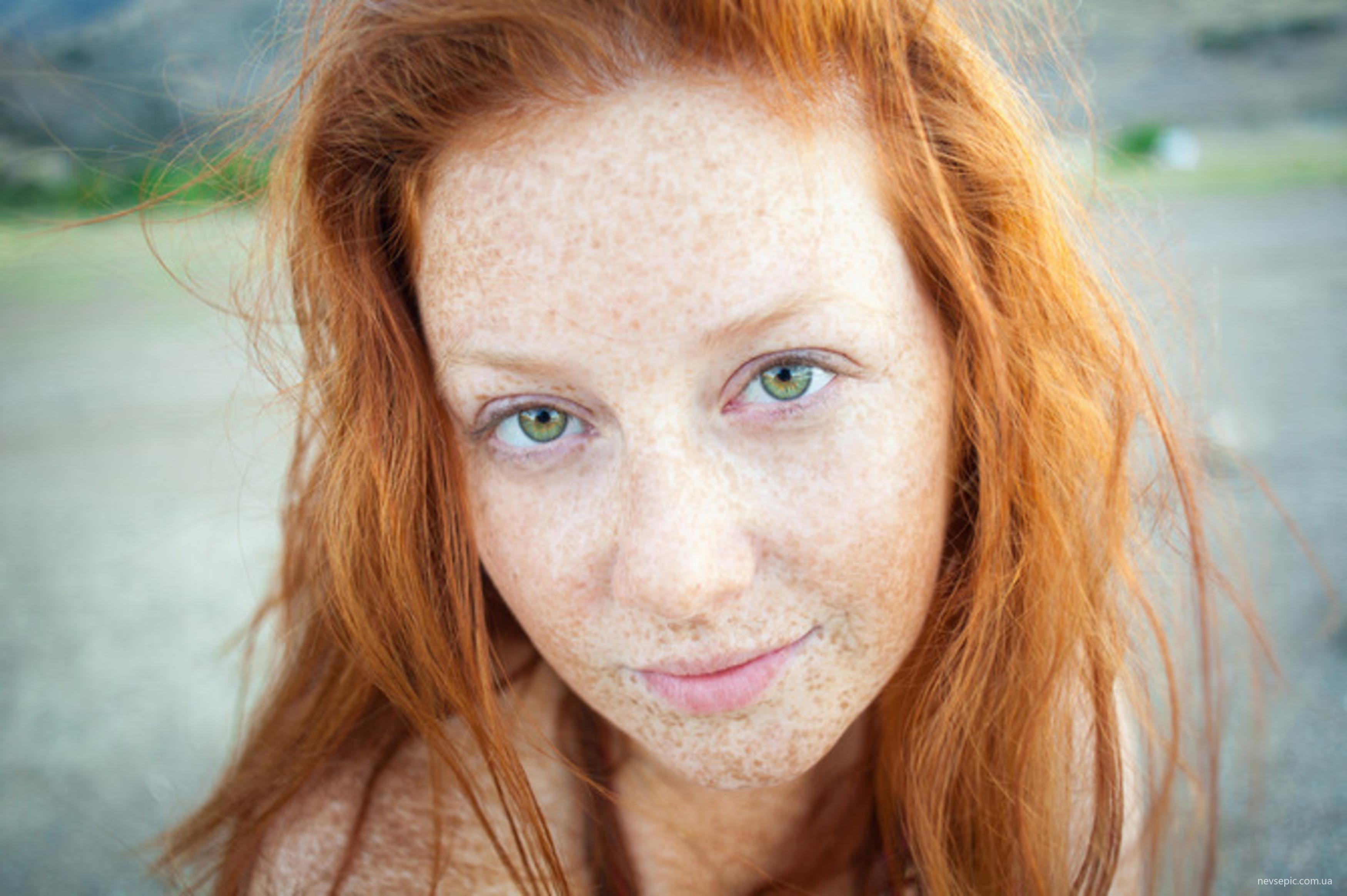 Pale Freckled Redhead In A Some Tmb